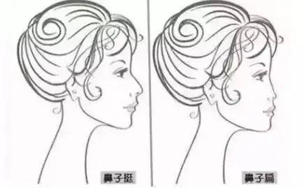 进行鼻骨内推不只是“推”，宽鼻改善轻易别动骨头啦！