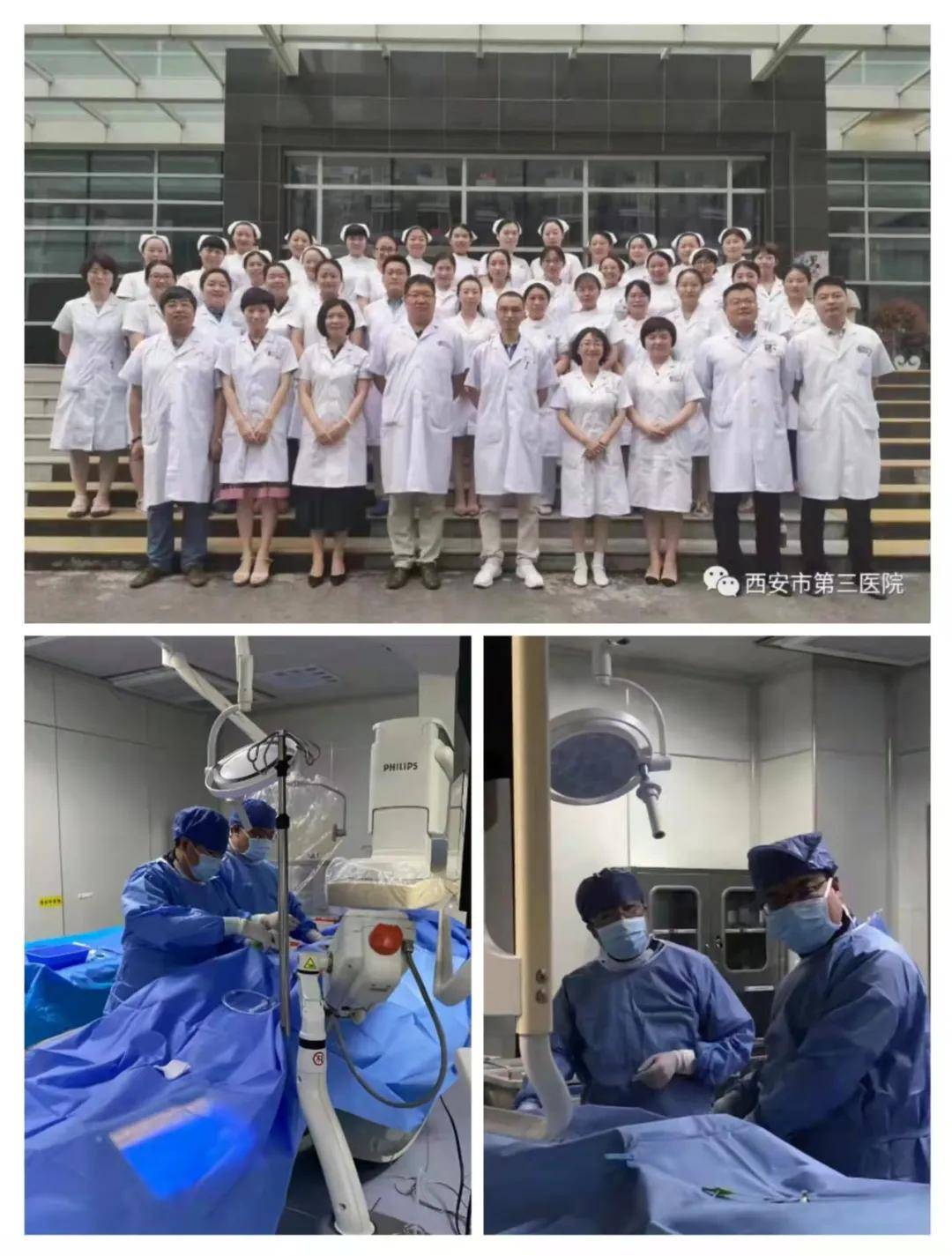 栓塞|西安市第三医院消化内科常年开展高难度介入TIPS术解决患者大难题