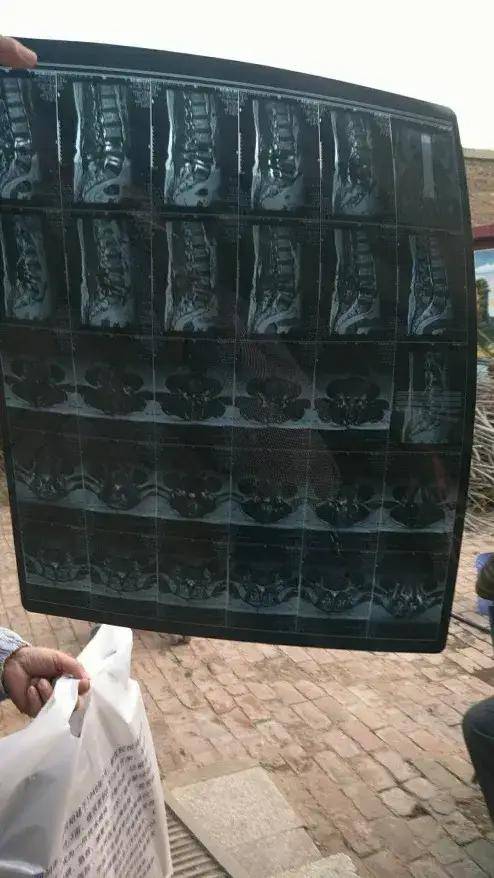 再这么拍,你都把我气笑了_片子_背景_腰椎