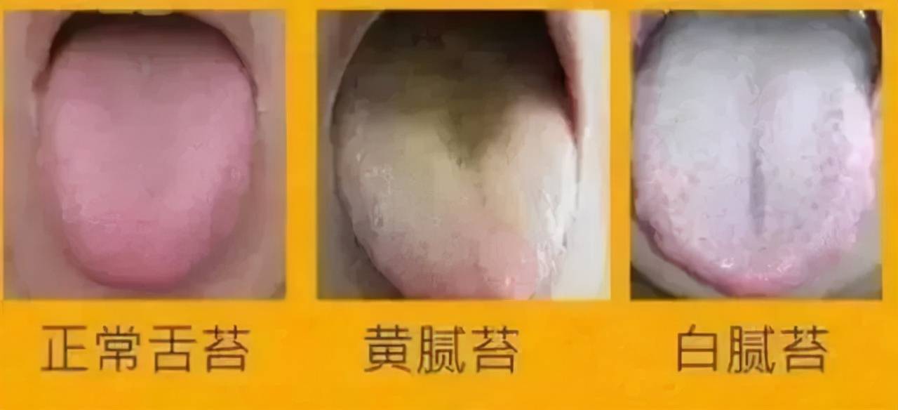 每天堅持喝一點,溼毒,小肚腩全趕跑_症狀_舌頭_頭髮