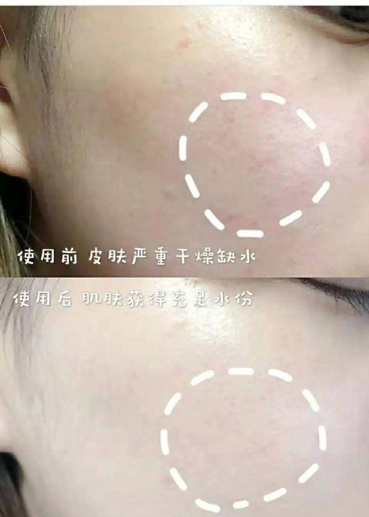 真嫩45岁佘诗曼不是装嫩是真嫩，高清怼脸近照皮肤细腻，护肤秘诀是它