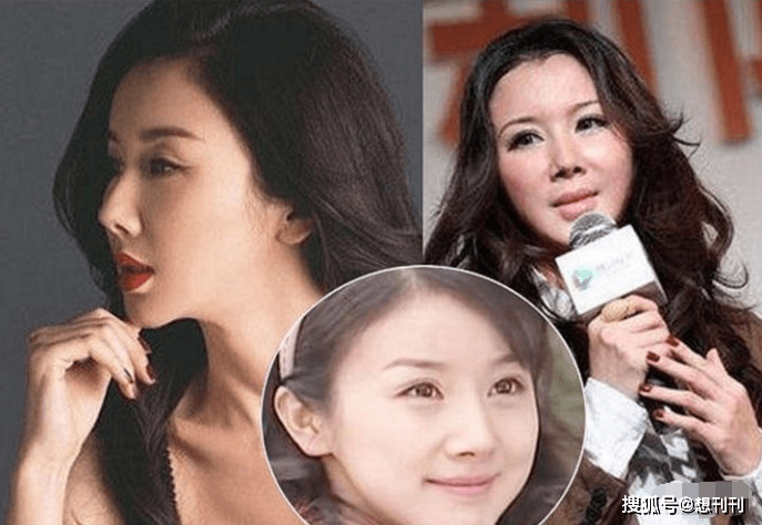 因为内娱“假鼻子”大PK,谁的假到逆天,谁的越整越残?