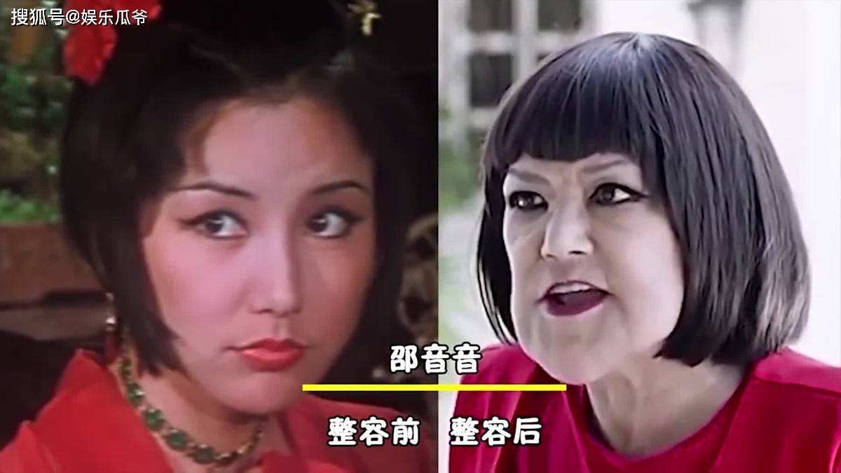 后遗症这些同龄女星都曾是绝世美人，有人整容后遗症像妖怪，有人美到老