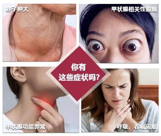 第九屆蝴蝶行動全國大型甲狀腺公益援助工程華中站正式啟動