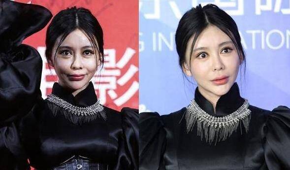 下巴明星的N种“假下巴”，尖到戳死人，翘成老巫婆，一个比一个怪异