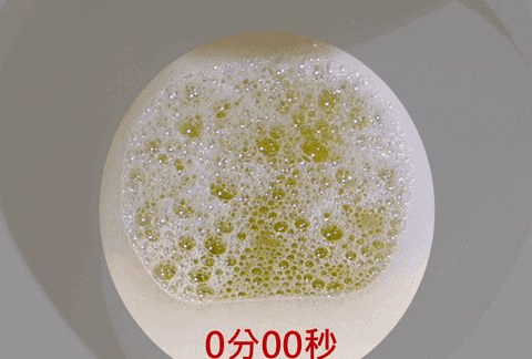 红灯|身体3处异常，或是尿酸飙升的“红灯”，切莫大意！