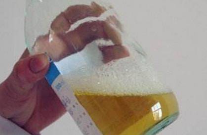 症状|尿液出现3种“泡沫”，早点去医院做检查，当心是疾病的信号