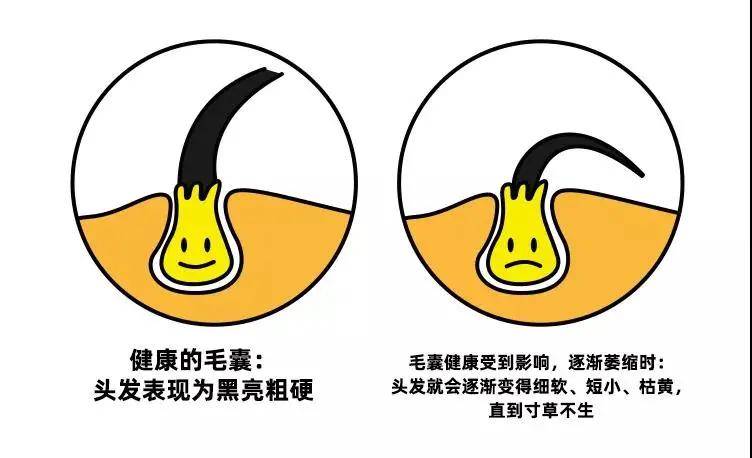 毛囊发际线对颜值的影响有多大?20岁的小姐姐秒变50岁的老阿姨…