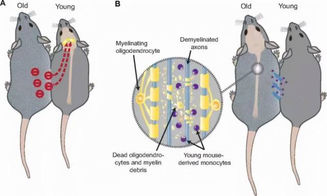 血液|换血续命还不够？《Nature》：注入新鲜血液后，可降低神经炎症风险