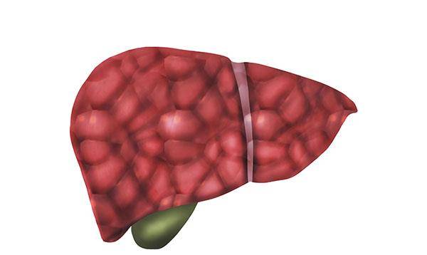 肝脏|肝病如果恶化，身体会有哪些前兆？遏制肝病恶化的措施有哪些？