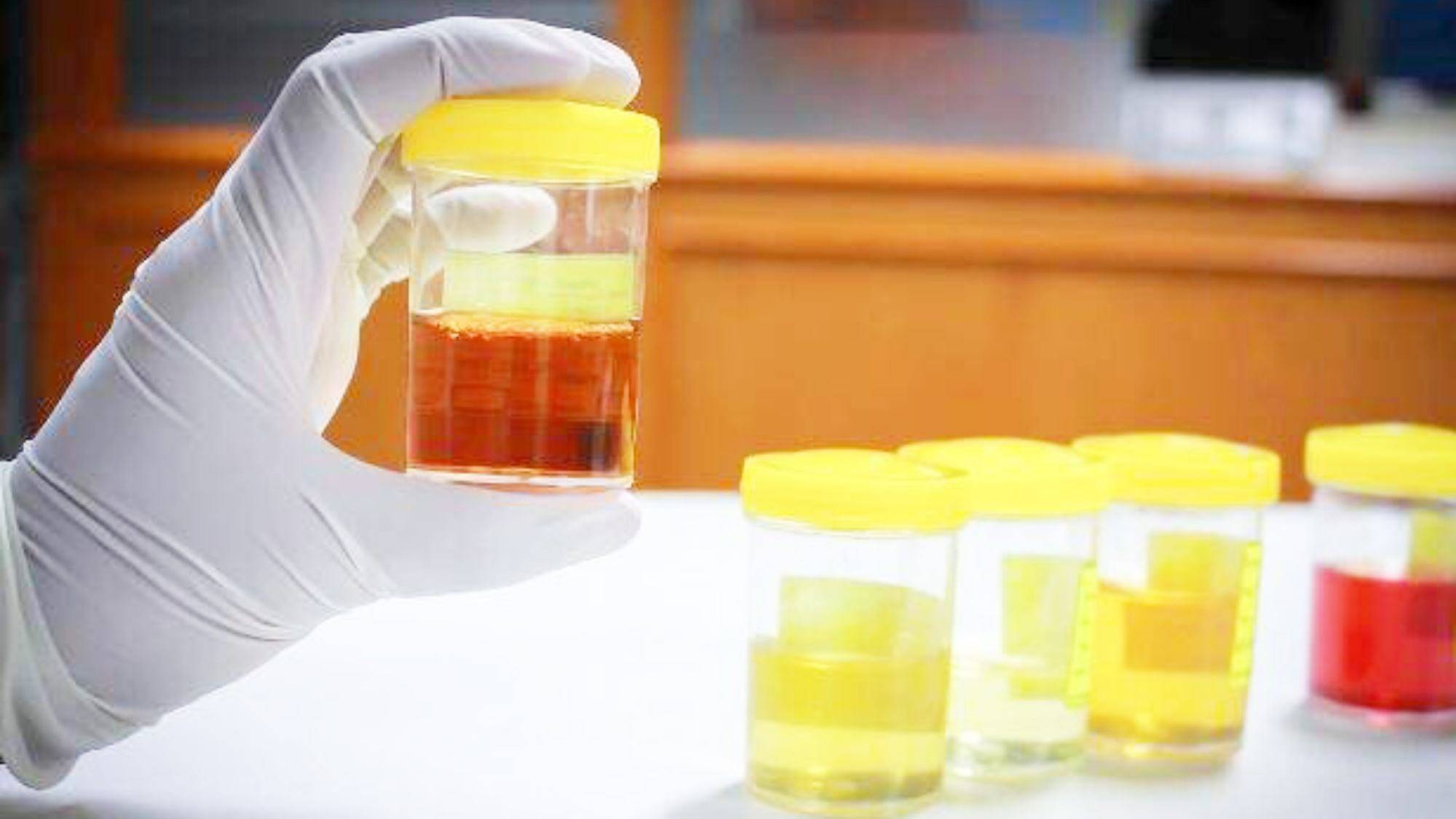 因为|大病一来脚先知。6表现说明肾危险，做好3件事，养好肾