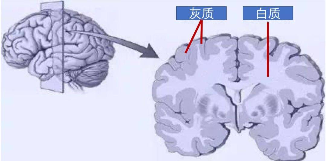 脑白质髓鞘化不良有先天性原因,也有后天性原因