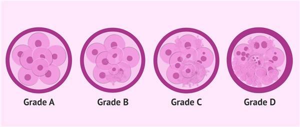試管胚胎等級是怎麼劃分定義的