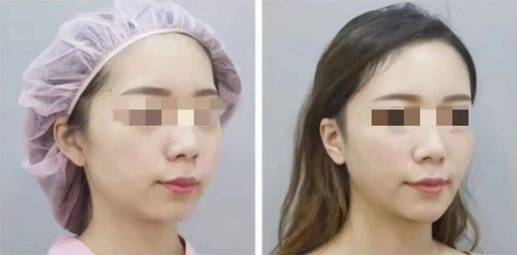 白天“再生医美”热度不减，精通TA的咨询师都年入百万了....