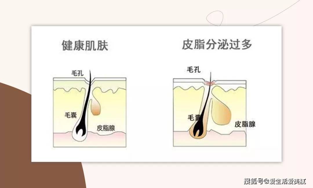 严重嘉宜老师小课堂|：这些陋习，让你变丑的速度超过99%的同龄人！
