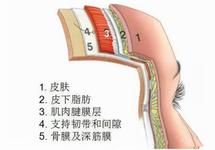 方法疑问来了：耳朵边上拉皮能维持几年？耳前拉皮手术后会留疤痕吗？