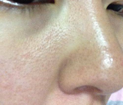 状况你为什么总是看起来这么没精打采?可能跟你肌肤状况有关系哦~