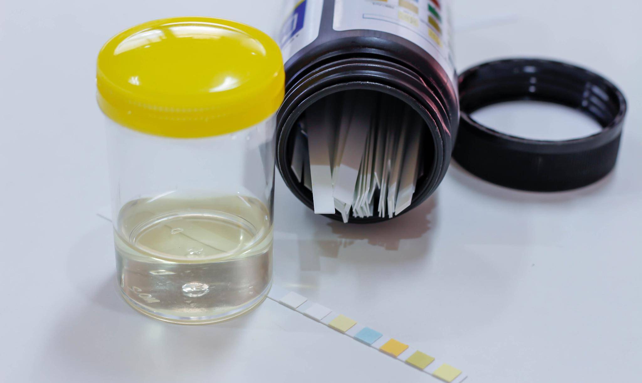 时间|还把肾癌和尿毒症混为一谈？一文教你区分，花时间了解下