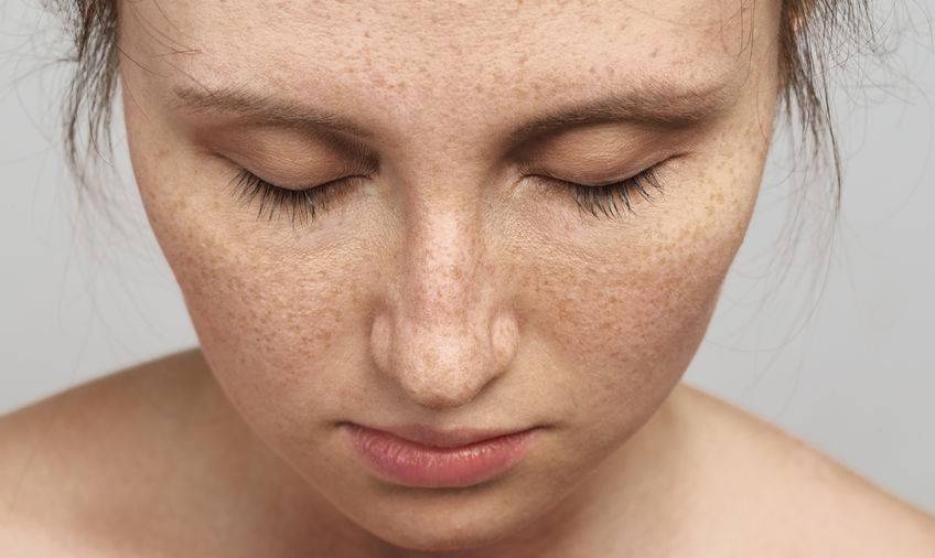 肝脏|患上肝病，脸上先知，提醒，出现这5个体征，是肝病的先兆