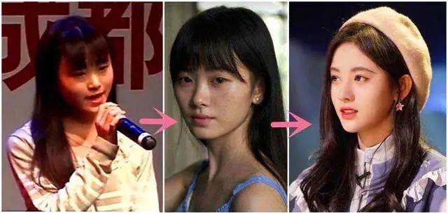 后遗症那些乱整鼻子的女星还好吗？后遗症一大堆，杨幂金晨都开始崩了