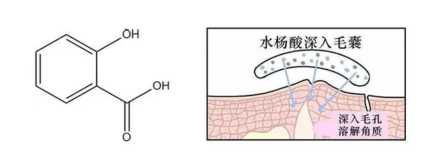 Stridex揭秘 | 水杨酸护肤品老品牌Stridex施颜适的故事