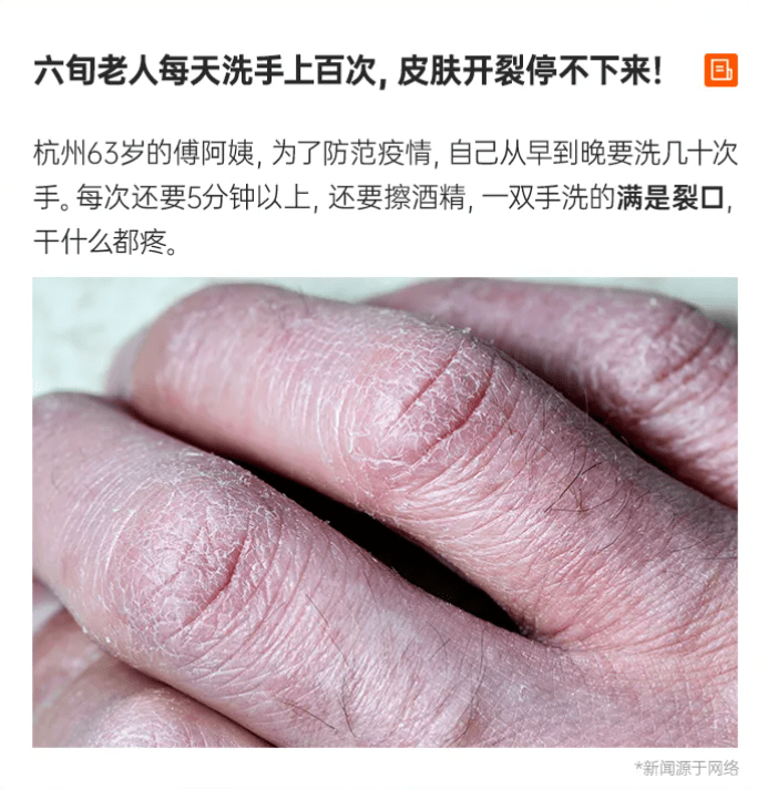 力健足力健教中老年人如何在冬天找回年轻嫩滑双手