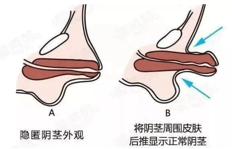 宝宝JJ大 六个月站立图片