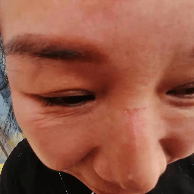 一张张青春靓丽的脸上是一道道口罩深深的勒痕,但她们毫不在意,手肿的