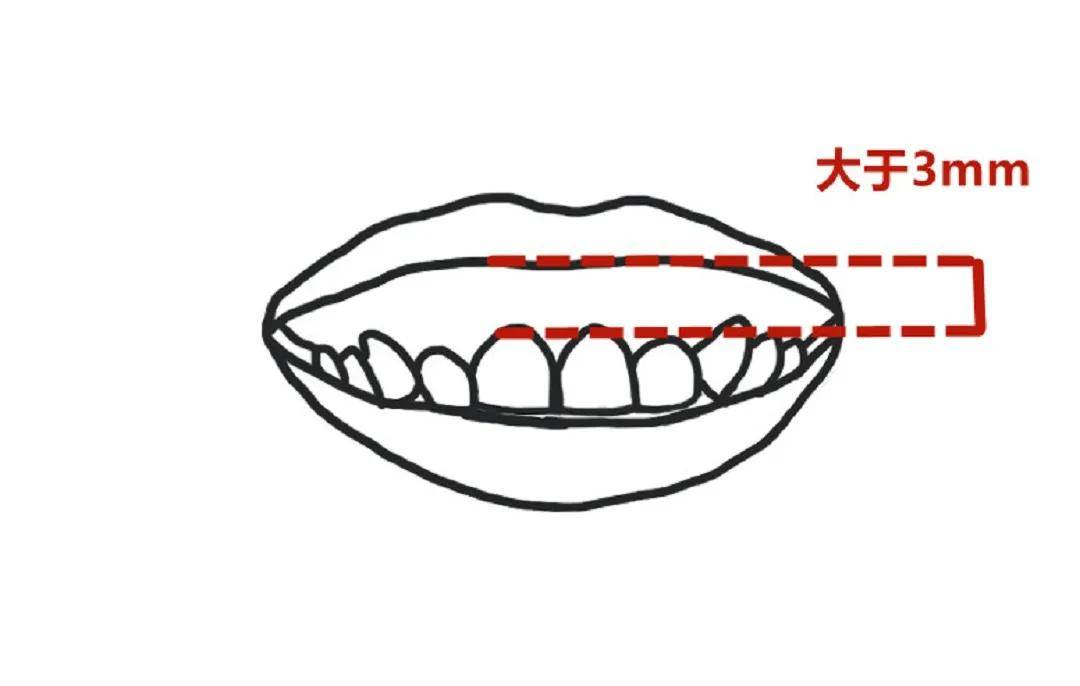 小天生图秒杀宋祖儿的天降紫微星，颜霸甜心可太绝了！
