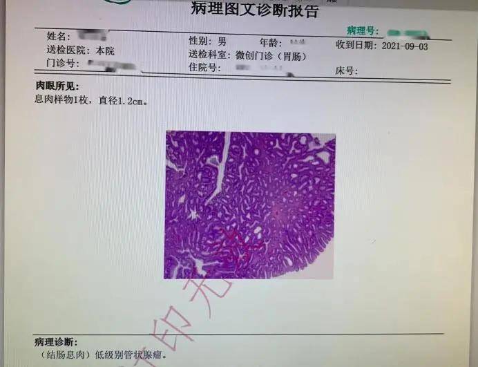 结肠息肉病理报告单图片