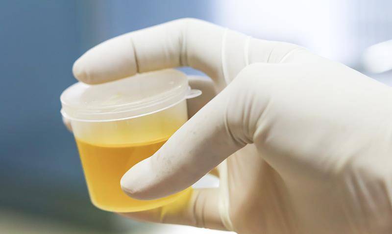 排尿酸的尿液是什么样的 c5eb12cb596a40a396f556f3b6572150.jpeg