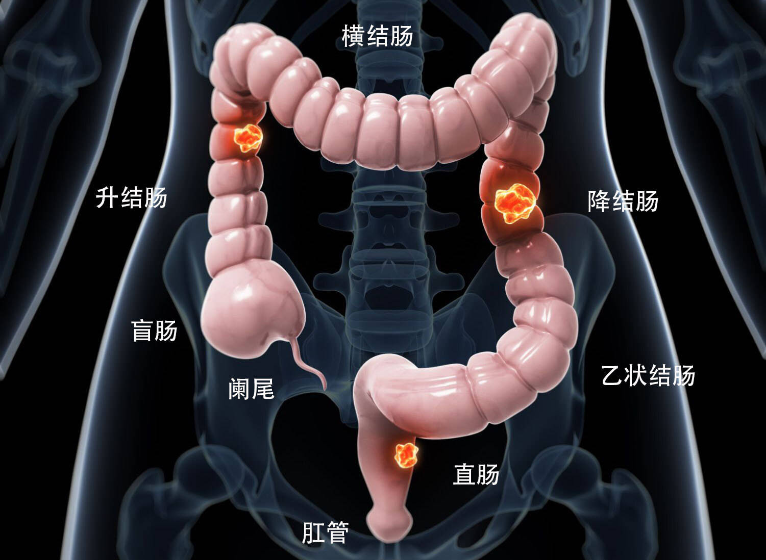 降结肠在人体哪个位置图片