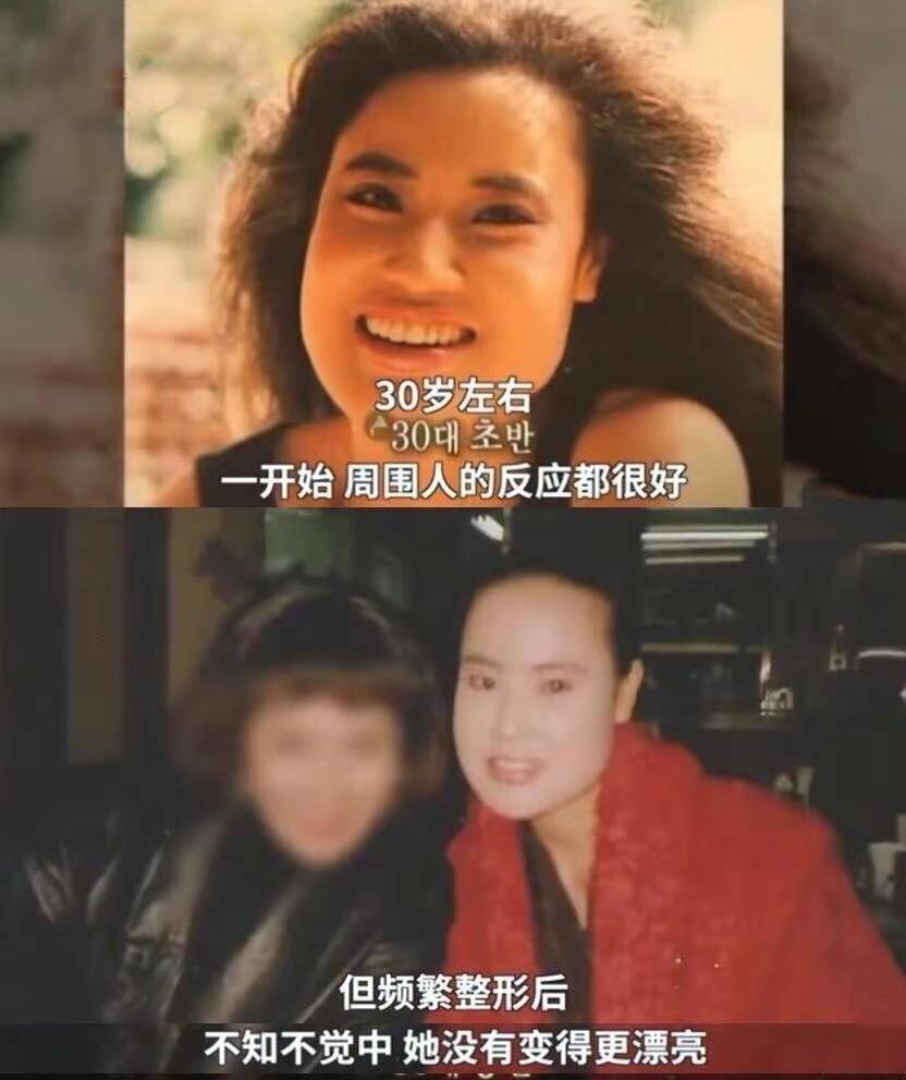 因为10位整容毁掉的女星：有人自己注射食用油，有人上瘾，有人丢了命