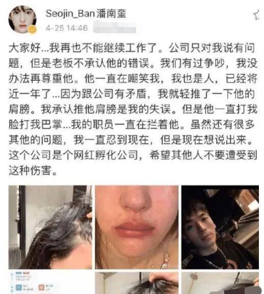 眼睛一张脸直10亿？南韩anglebaby花费巨资整容，如今怎么样了？