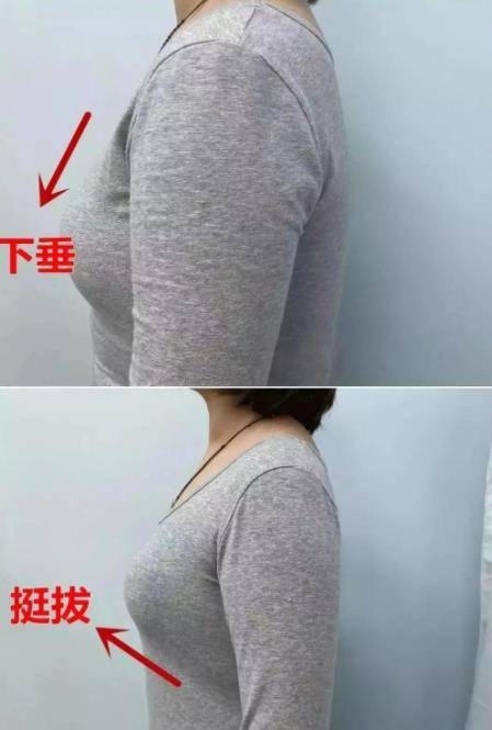 女生怎样让胸不下垂 283bfb554d3c4d96b53ccacaf2764001.jpeg