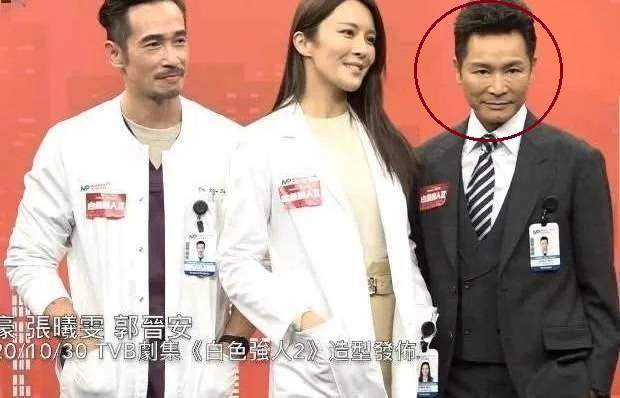 因为男明星整容后遗症更可怕，有的变成悲伤蛙，有的差点认不出来