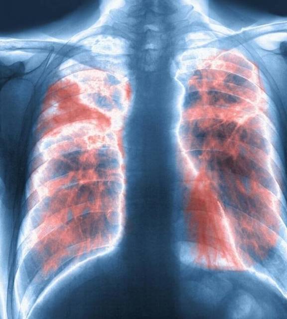 治疗|呼吸道潜在的高危疾病，你注意到了吗？