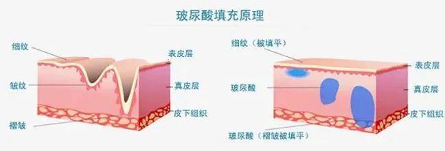 姐妹想要过年光彩照人？这些“应急”项目简直不要太香
