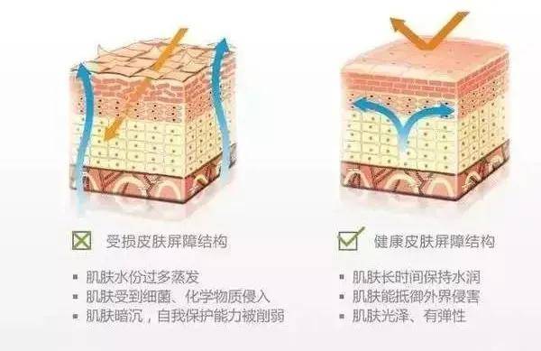 治疗美肤医师郭金月：想要皮肤水嫩，该选择光子嫩肤还是水光？