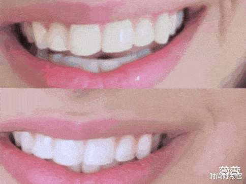 不用刷牙的健康小妙招 406d119c25834691bedb3eef19946235.gif