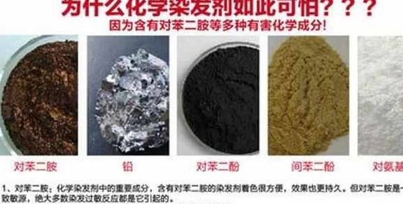 头皮过年染发前需要弄清楚这4件事，医生说，这些人不建议染头发！