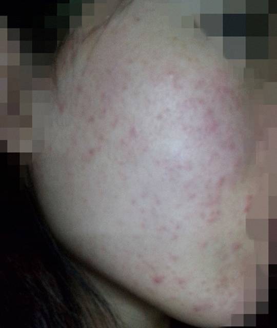 化妆品美女用代购化妆品被毁容，前男友来安慰却被发现大秘密