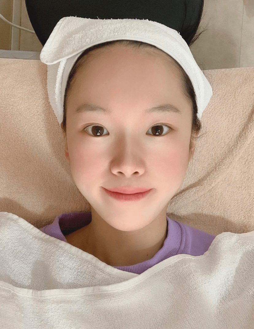 进行冬季皮肤干燥，除了补水，这些护肤步骤也很重要，你重视了吗？