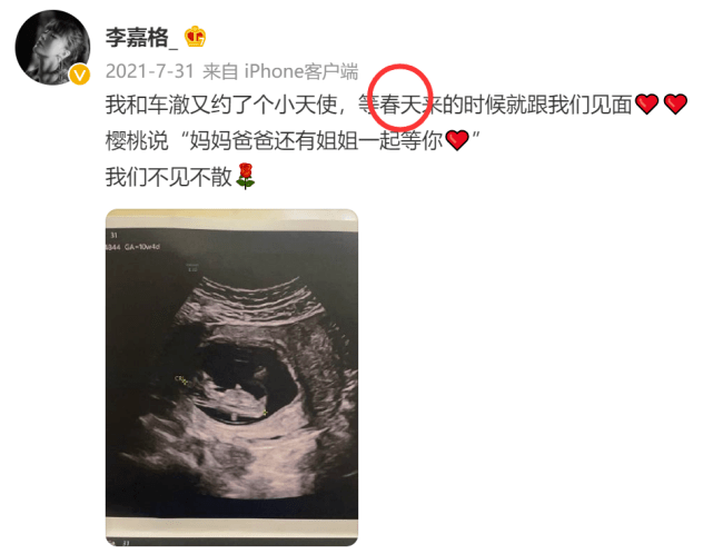 身份|歌手李嘉格官宣二胎得子，晒母子合影超温馨，取名核桃长相随车澈