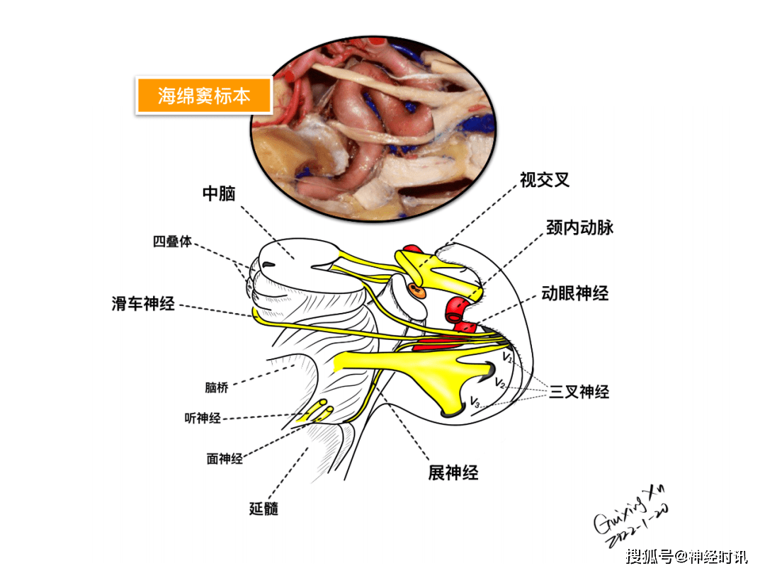 此篇主要講解鞍區的重要性,鞍區的精細解剖,鼻腔骨性結構,蝶鞍-垂體窩