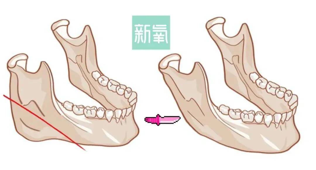 八大处甜茶：别问，问就是发腮了...