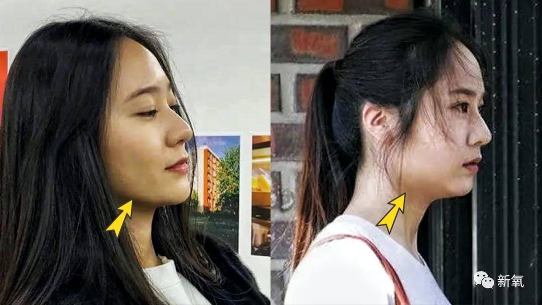 八大处甜茶:别问,问就是发腮了...