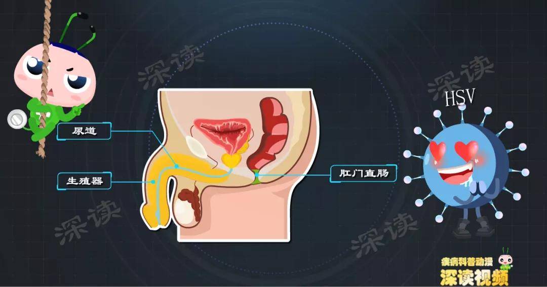 生殖器疱疹知识普及的简单介绍-第2张图片-鲸幼网