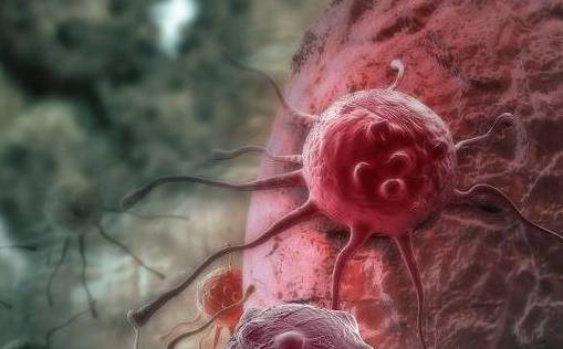 小淋巴细胞淋巴瘤能治吗 8ffe33534e0a4987a4157e721eac5a88.jpeg