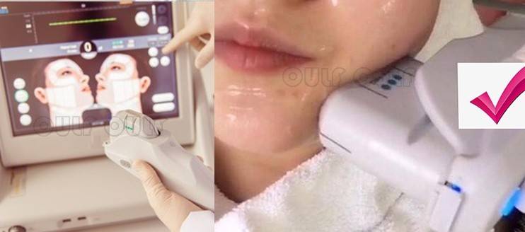 于超声老司机：做超声刀有效果吗？做过超声刀后的保养核心在这里~